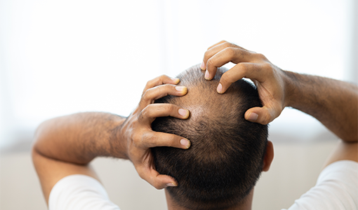 Root Case of Hair Loss